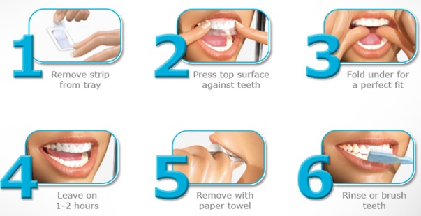 Advanced Teeth Whitening Stripes    -  10