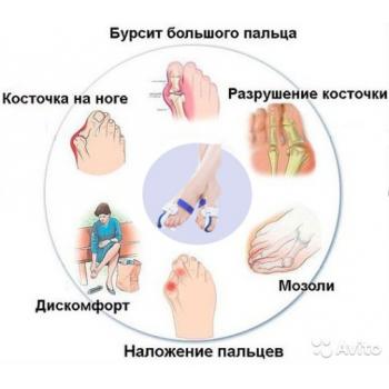 Ортопедический ночной вальгусный бандаж для большого пальца